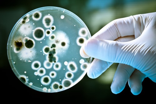 Hand wearing protective gloves holding a petri dish filled with bacteria over a bright light to show its silhouette.